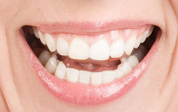 istock Smiling woman mouth with teeth 106553943