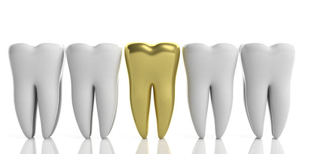 istock White tooth models and one gold isolated on white background. 3d illustration 1065706818