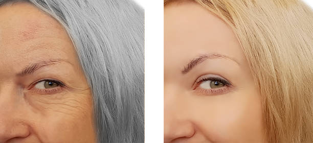 istock woman aging before and after concept gray 1065765014