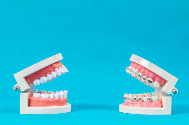 istock Compare tooth model and tooth model with metal wire 1065824410