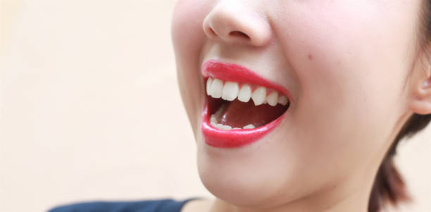 istock Woman mouth smile with great teeth on background. 1066200676