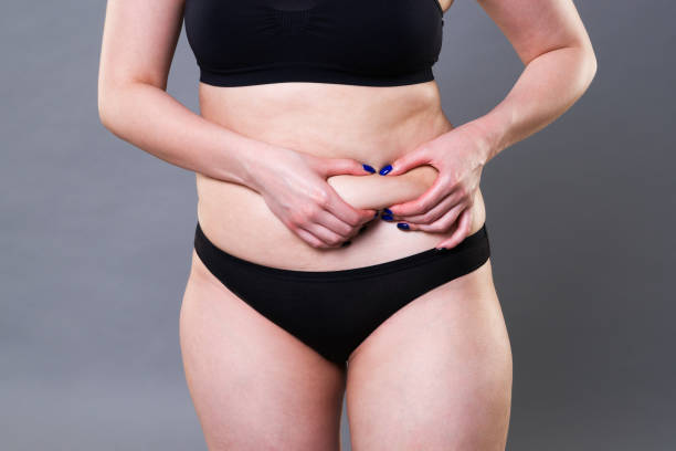 frau mit falten der haut, cellulite an den weiblichen körper auf grauem hintergrund - overweight tummy tuck abdomen body stock-fotos und bilder