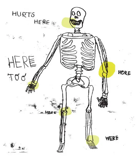 Vector illustration of Human skeleton