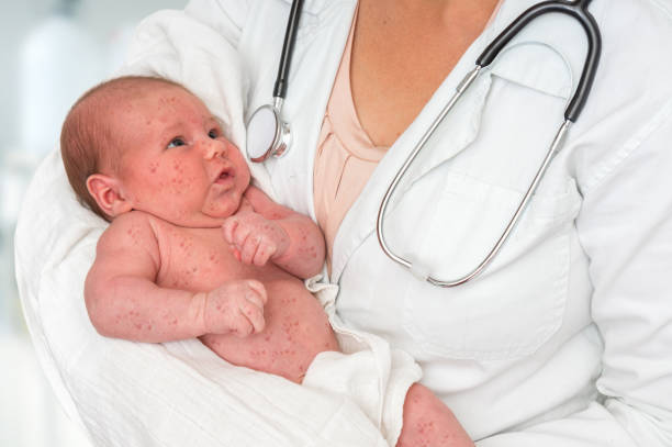 Doctor holding a newborn baby which is sick rubella or measles Doctor with stethoscope holding a newborn baby which is sick rubella or measles measles stock pictures, royalty-free photos & images