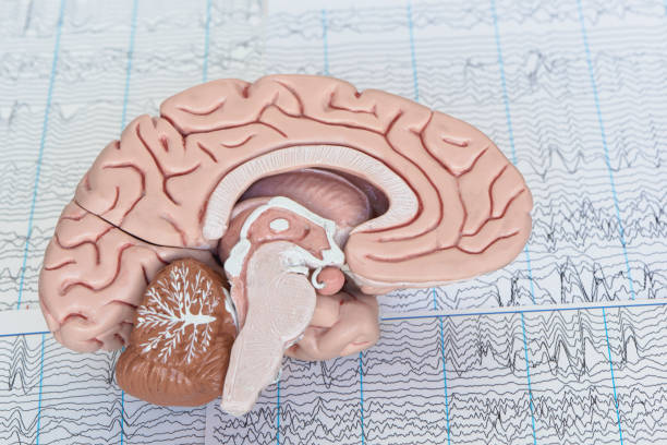 human brain model on background of brain waves - eeg epilepsy science electrode imagens e fotografias de stock