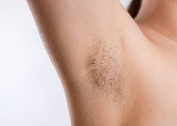 woman with armpit hair, female hairy armpit, - beautician beauty treatment smooth human leg imagens e fotografias de stock