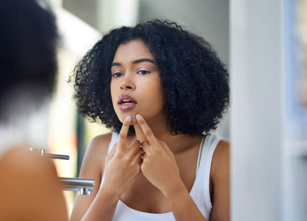 istock Ain't nobody got time for zits 1066947488