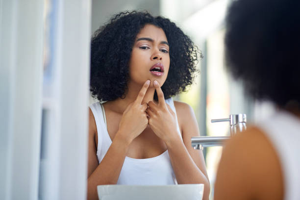 istock Oh no, not on my face! 1066947504