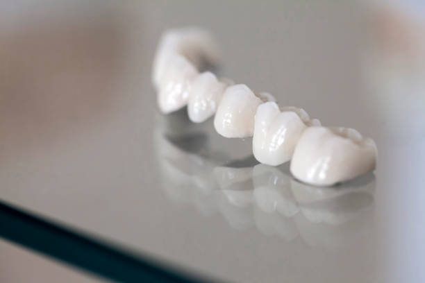 piatto dentale in porcellana zirconio in negozio dentista - artificial metal healthcare and medicine technology foto e immagini stock