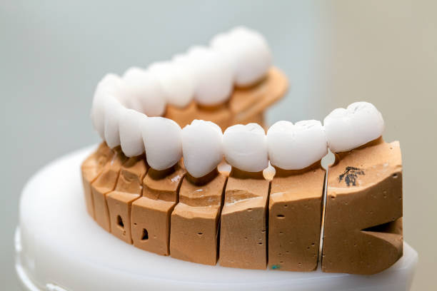 zirkonium porzellan zahn platte im zahnarzt-store - dental hygiene laboratory dental equipment technician stock-fotos und bilder