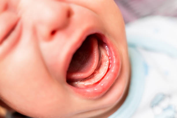 Close up photo of crying 3 months old baby mouth. Bare gums without teeth. stock photo