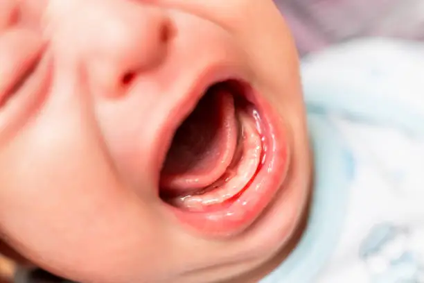 Photo of Close up photo of crying 3 months old baby mouth. Bare gums without teeth.