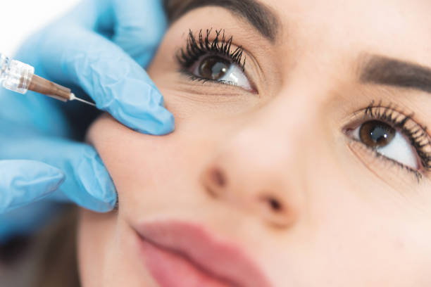 istock Cheek hyaluron fillers 1068356022