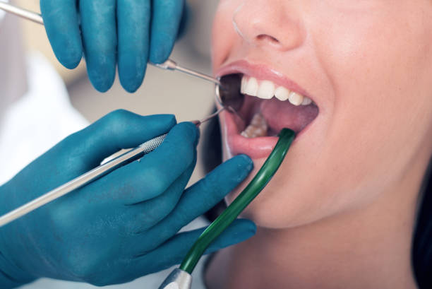istock Dentist tools and mouth open with beautiful teeth 1068853604