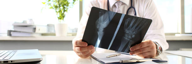 medico maschio tenere in braccio penna d'argento e guardare raggi x - ortopedico foto e immagini stock