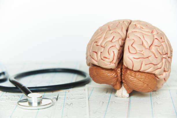 human brain model and a black stethoscope on background of brain - eeg epilepsy science electrode imagens e fotografias de stock