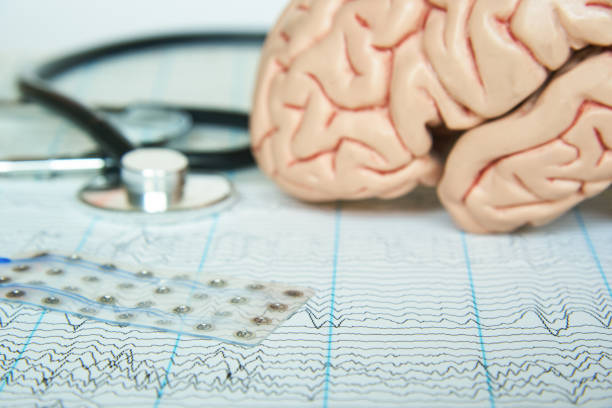 electrode recording brain waves on eeg paper - eeg epilepsy science electrode imagens e fotografias de stock