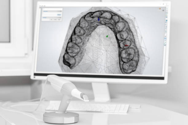 dental 3d scanner y el monitor en la oficina del dentista - machine teeth fotos fotografías e imágenes de stock