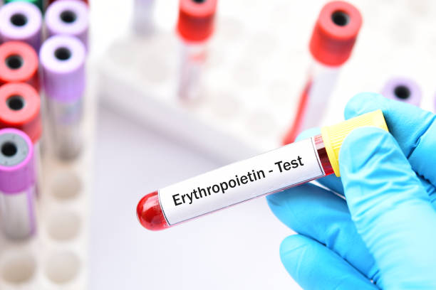 Blood sample for erythropoietin test Blood sample tube for erythropoietin test, stimulate hormone for red blood cell production erythropoietin stock pictures, royalty-free photos & images