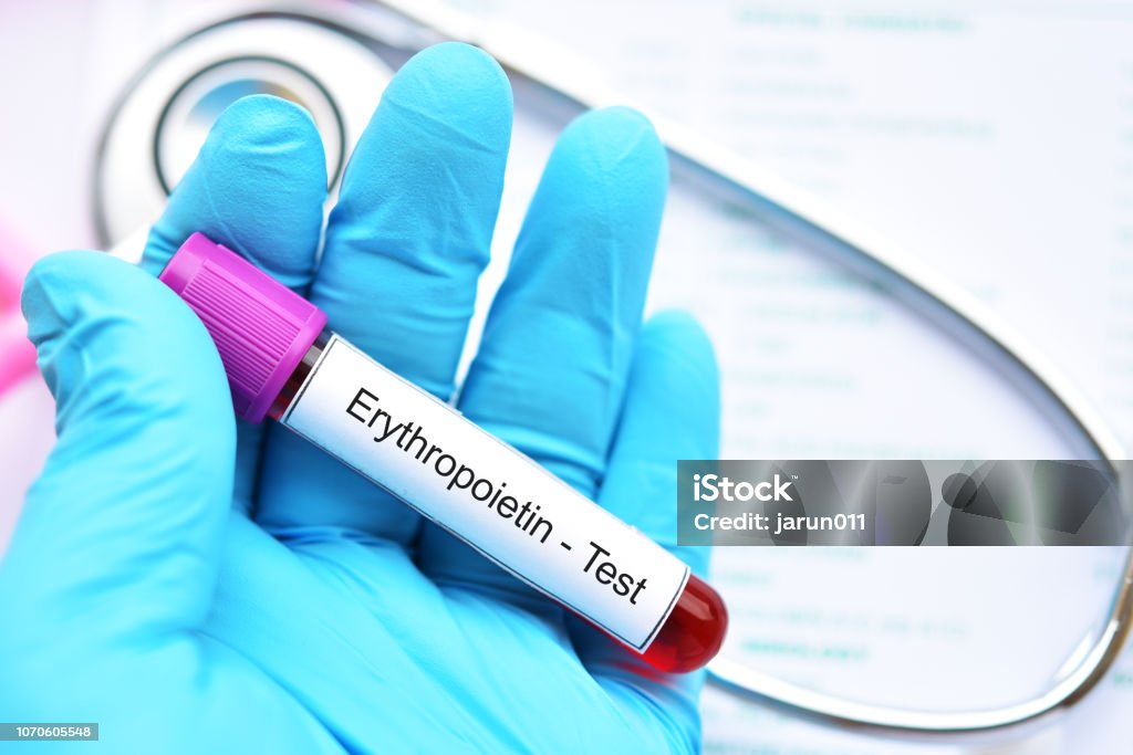 Blood sample for erythropoietin test Blood sample tube for erythropoietin test, stimulate hormone for red blood cell production Anemia Stock Photo