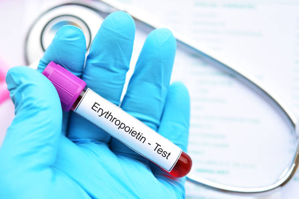 Blood sample for erythropoietin test Blood sample tube for erythropoietin test, stimulate hormone for red blood cell production erythropoietin stock pictures, royalty-free photos & images