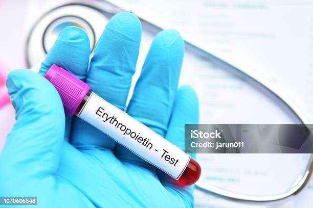 Blood Sample For Erythropoietin Test Stock Photo - Download Image Now - Anemia, Kidney - Organ, Erythropoietin