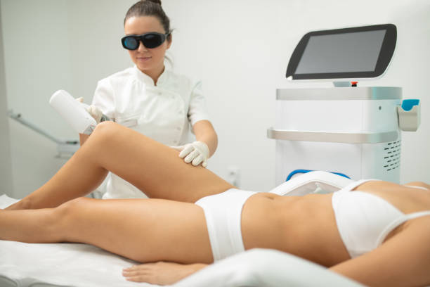 Young woman on laser hair removal treatment Beautiful young woman receiving laser body hair removal treatment at beauty and health clinic. Beautician is also young and concentrated. Treatment on legs medical laser photos stock pictures, royalty-free photos & images