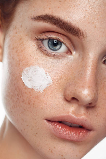 istock Girl inflicting cream 1071144520