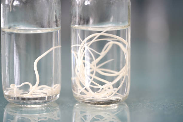istock Ascariasis is a disease caused by the parasitic roundworm in fixative solution for education. 1071227390