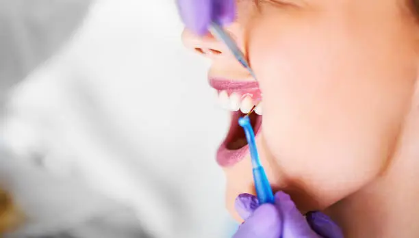 Photo of Dentist measure the interdental space with the patented probe.