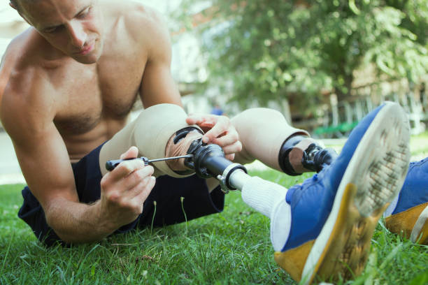 istock Maintenance of prosthetic leg before training 1071397296