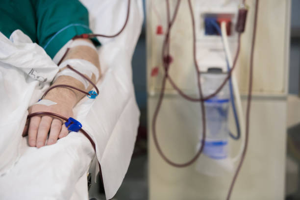 machines d’hémodialyse avec tubulure., transplantation, le concept de matériel médical. - dialyse photos et images de collection