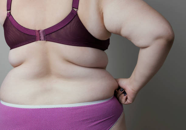 istock Obesity female body 1071542644