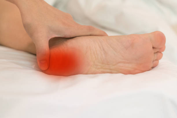 Heel Pain or plantar fasciitis concept. Hand on foot as suffer from inflammation feet problem of Sever's Disease or calcaneal apophysitis. Heel Pain or plantar fasciitis concept. Hand on foot as suffer from inflammation feet problem of Sever's Disease or calcaneal apophysitis. human foot stock pictures, royalty-free photos & images