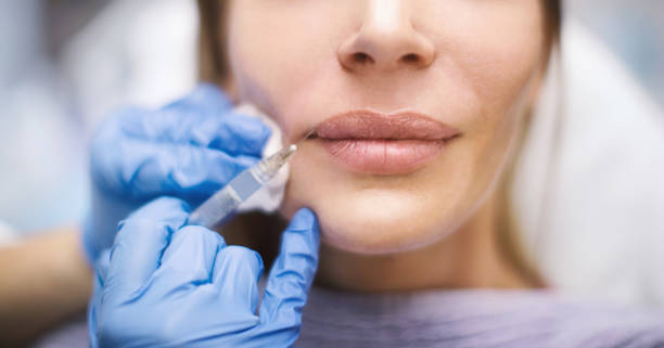 aumento delle labbra. - attractive female human collagen syringe injecting foto e immagini stock