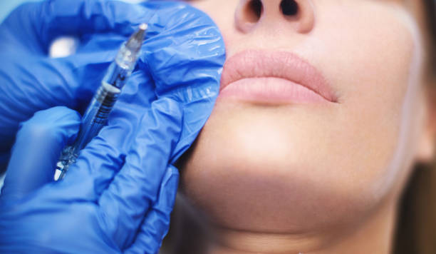 istock Nasolabial beauty injection. 1072102080