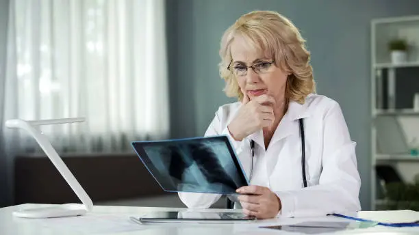 Concerned female pulmonologist examining X-ray of patient's lungs, diagnostics