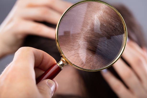 istock Dermatologist Examining Woman's Hair 1072409822
