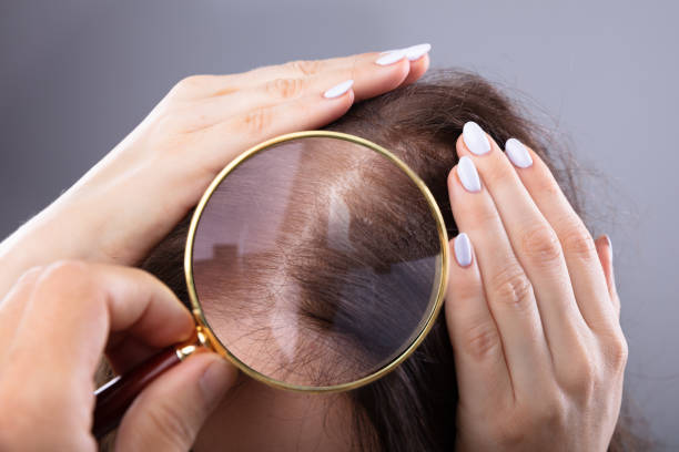 dermatologo che esamina i capelli della donna - loose hair foto e immagini stock