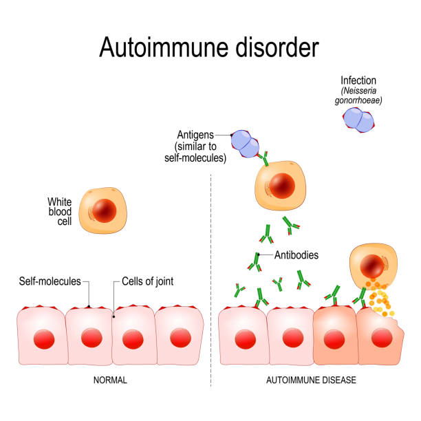 자가 면역 질환 - macrophage human immune system cell biology stock illustrations