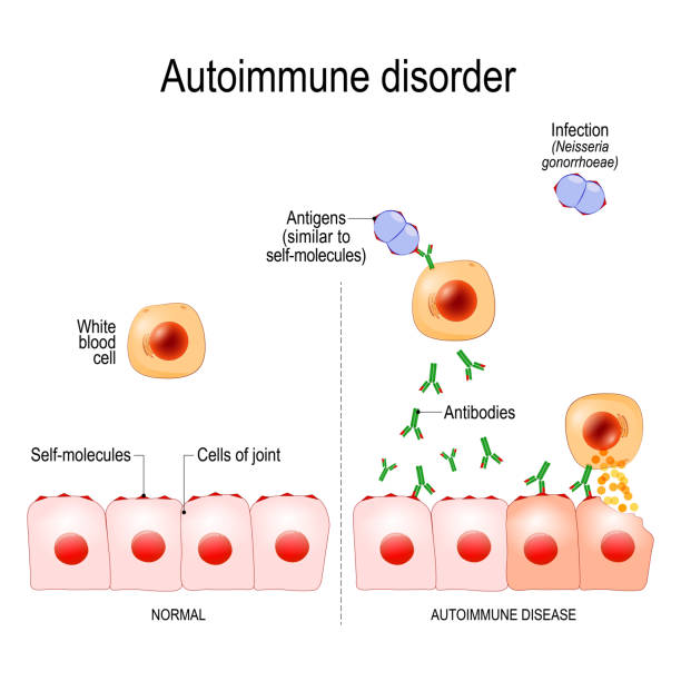 Autoimmune Disorders Stock Illustration - Download Image Now - Autoimmunity,  Antibody, Biological Cell - iStock