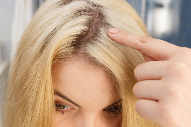 1. How to Fix Short Blonde Hair Roots - wide 3