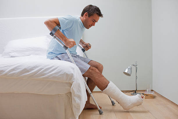 homme avec une jambe cassée vous recevoir de lit - healthcare and medicine home interior side view vertical photos et images de collection