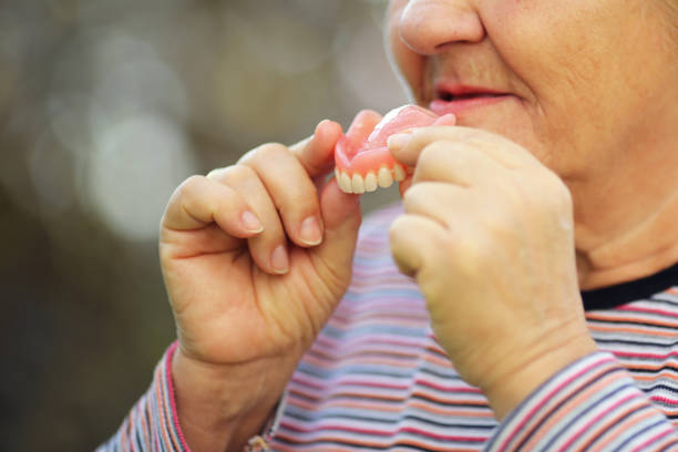 Senior woman taking the teeth out stock photo