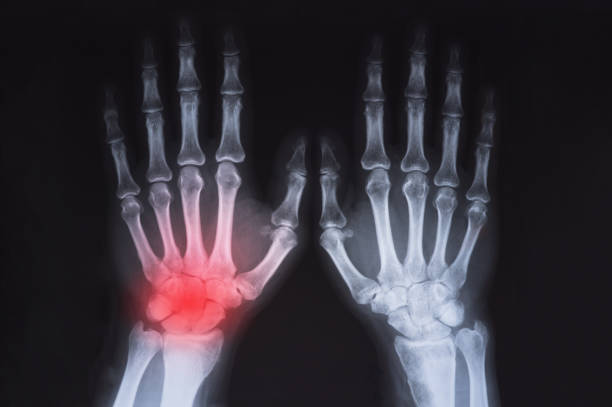 x ray hand on black. OK