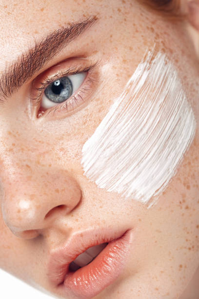 istock Girl inflicting cream 1074788860