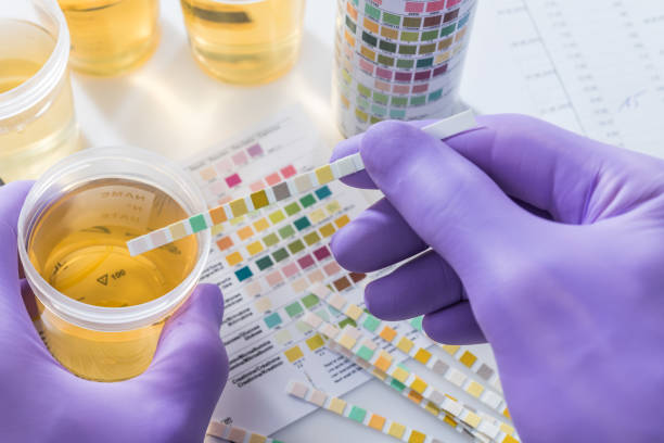 strisce di test delle urine in guanti viola - doping test foto e immagini stock