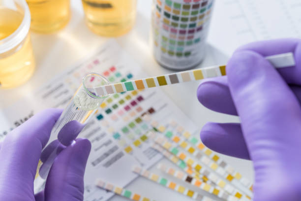 urine test strips in purple gloves Test tires in violet gloves with test chart and urine can workplace absence stock pictures, royalty-free photos & images
