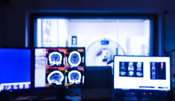 Blurred background of  Computed tomography ( CT scan ) room  with control workstation and monitors.