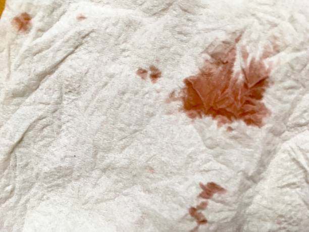 istock blood on tussue paper 1074905220